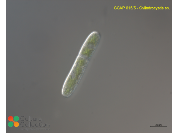 Cylindrocystis sp. Cylindrocystis sp.
