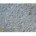 Chroococcus turgidus