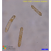 Corethron criophilum
