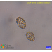 Corethron criophilum