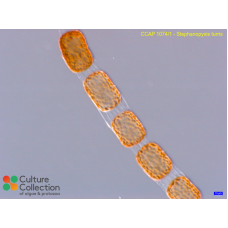 Stephanopyxis turris